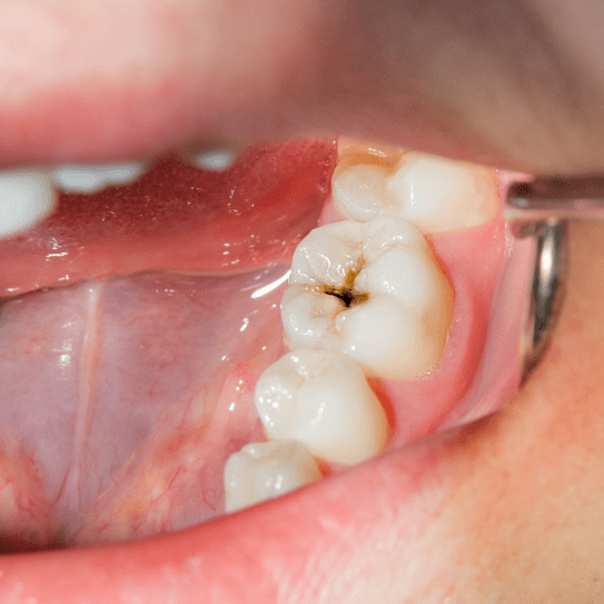 centralia dentist